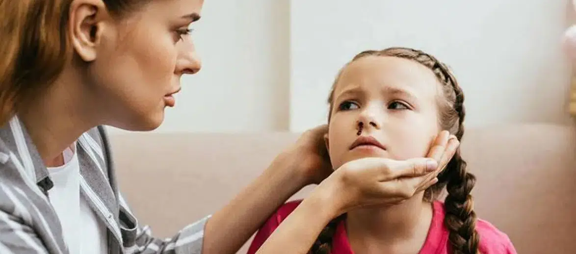 Çocuklarda Burun Kanamaları Ciddiye Alınmalı: Nedeni Lösemi Olabilir