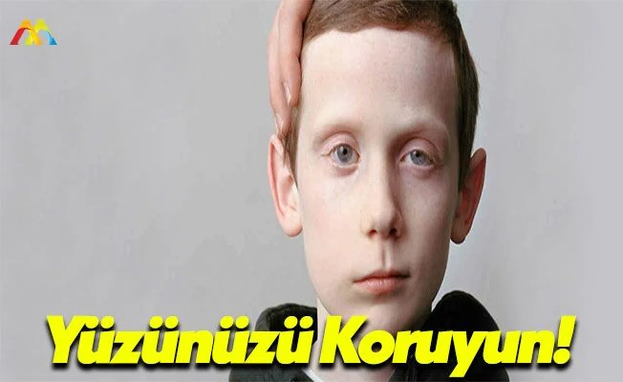 Nöroloji Uzmanı Prof. Dr. Zülküf Önal: Yüz Felcine Neden Oluyor!