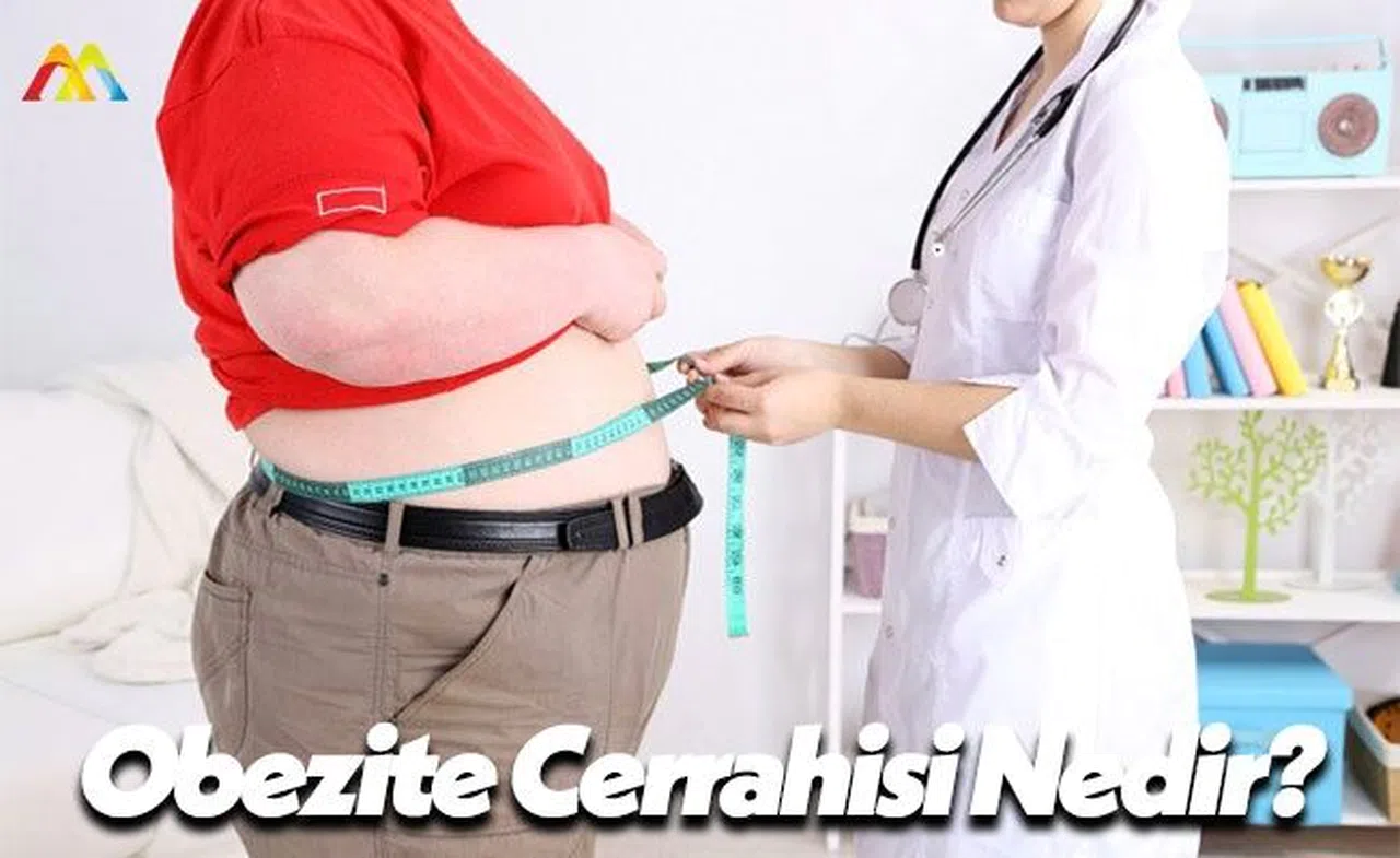 Obezite Cerrahisi Nedir?