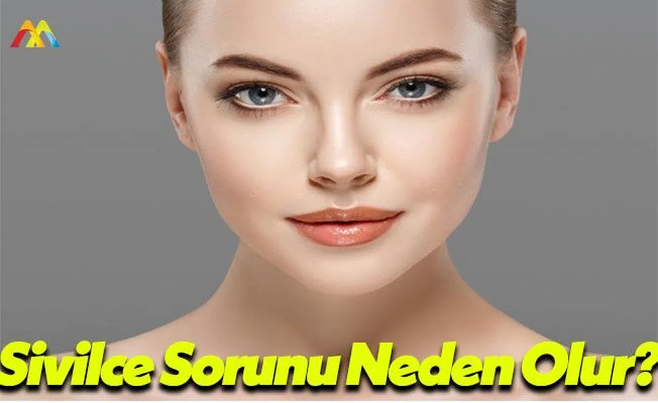 Uzmanlardan Sivilce Sorunu İle İlgili Açıklama!