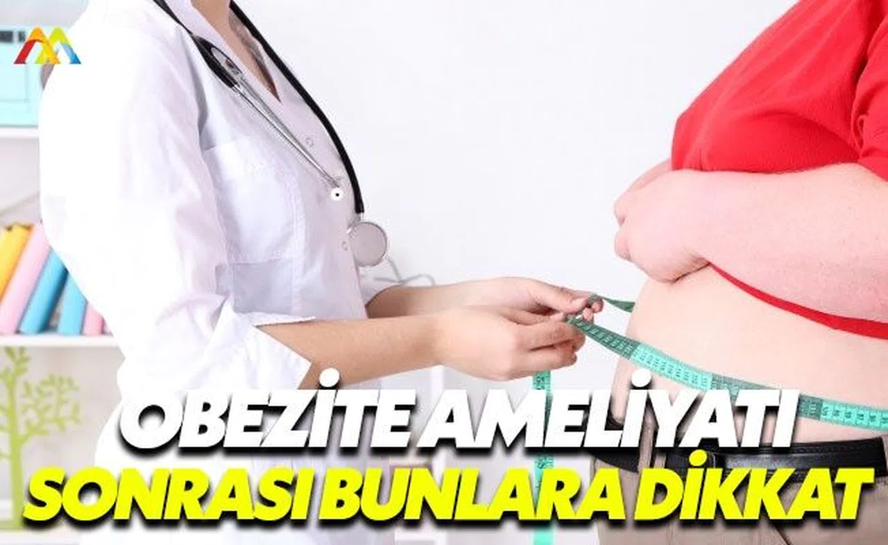 Obezite ameliyatı sonrası yapılması gerekenler