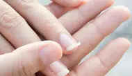 Tırnaklarınız güçsüz mü? İşte en etkili doğal ve eczane destekli yöntemler