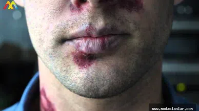 AIDS Cinsel Yolla Nasıl Geçiyor? AIDS Tedavisi Nedir?