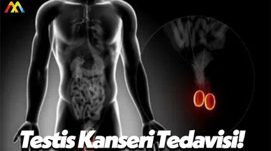 Testis Kanseri Kimlerde Olur ve Kimlerde Daha Çok Görülür?