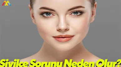 Uzmanlardan Sivilce Sorunu İle İlgili Açıklama!