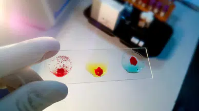 Araştırmaya Göre Acıya En Dayanıklı Kan Grubu Şaşırttı