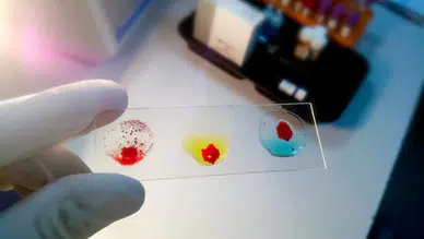 Araştırmaya Göre Acıya En Dayanıklı Kan Grubu Şaşırttı