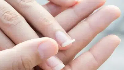 Tırnaklarınız güçsüz mü? İşte en etkili doğal ve eczane destekli yöntemler
