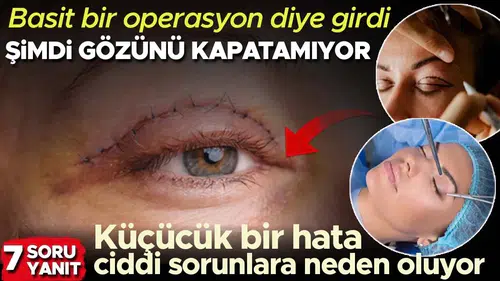 Basit Bir Operasyon Olmasına Rağmen Göz Kapağı Estetiği Riskleri