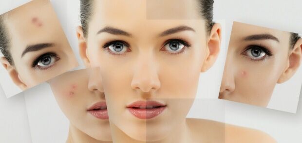 İşte 10 Yaş Gençleştirecek Maske Tarifleri 1